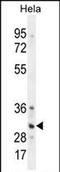 TNFRSF1A Associated Via Death Domain antibody, PA5-71607, Invitrogen Antibodies, Western Blot image 