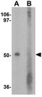 Glycerophosphodiester Phosphodiesterase Domain Containing 5 antibody, GTX32133, GeneTex, Western Blot image 