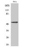 Myocyte Enhancer Factor 2A antibody, STJ94064, St John