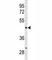 Angiopoietin Like 4 antibody, F51590-0.4ML, NSJ Bioreagents, Western Blot image 