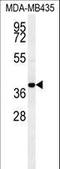 C-C Motif Chemokine Receptor 8 antibody, LS-C168492, Lifespan Biosciences, Western Blot image 