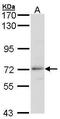 Beta-Transducin Repeat Containing E3 Ubiquitin Protein Ligase antibody, PA5-27756, Invitrogen Antibodies, Western Blot image 