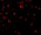 Interleukin 1 Receptor Associated Kinase 1 antibody, A01021-2, Boster Biological Technology, Immunofluorescence image 