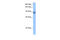 Neural EGFL Like 2 antibody, 30-218, ProSci, Enzyme Linked Immunosorbent Assay image 