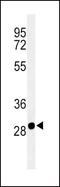 Solute Carrier Family 25 Member 37 antibody, PA5-26720, Invitrogen Antibodies, Western Blot image 