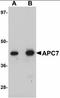 Anaphase-promoting complex subunit 7 antibody, orb89873, Biorbyt, Western Blot image 