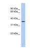 Aquaporin 10 antibody, NBP1-62621, Novus Biologicals, Western Blot image 