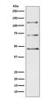 Complement C3 antibody, M00168-2, Boster Biological Technology, Western Blot image 