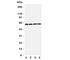 Solute carrier family 22 member 7 antibody, R31312, NSJ Bioreagents, Western Blot image 