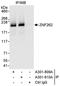 Zinc Finger MYM-Type Containing 4 antibody, A301-810A, Bethyl Labs, Immunoprecipitation image 