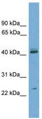 Rhox-6 antibody, TA341806, Origene, Western Blot image 