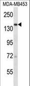 URB2 Ribosome Biogenesis Homolog antibody, LS-C160456, Lifespan Biosciences, Western Blot image 