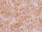 NFKB Inhibitor Interacting Ras Like 2 antibody, NBP2-19545, Novus Biologicals, Immunohistochemistry paraffin image 