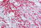 Keratin 17 antibody, MBS247528, MyBioSource, Immunohistochemistry frozen image 