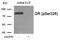 Nuclear Receptor Subfamily 3 Group C Member 1 antibody, GTX55389, GeneTex, Western Blot image 