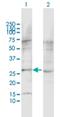 Adhesion G Protein-Coupled Receptor L1 antibody, H00022859-D01P, Novus Biologicals, Western Blot image 