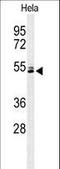 Keratin 78 antibody, LS-C165394, Lifespan Biosciences, Western Blot image 
