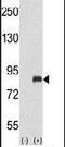 G Protein-Coupled Receptor Kinase 3 antibody, PA5-26101, Invitrogen Antibodies, Western Blot image 
