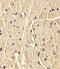 Procollagen-Lysine,2-Oxoglutarate 5-Dioxygenase 1 antibody, PA5-48414, Invitrogen Antibodies, Immunohistochemistry paraffin image 