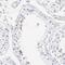 Actin Related Protein T1 antibody, PA5-51828, Invitrogen Antibodies, Immunohistochemistry paraffin image 