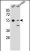 Guanine nucleotide-binding protein G(s) subunit alpha isoforms short antibody, PA5-71778, Invitrogen Antibodies, Western Blot image 