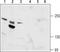 Transient Receptor Potential Cation Channel Subfamily M Member 6 antibody, TA328748, Origene, Western Blot image 