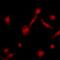 G Protein-Coupled Receptor Kinase 2 antibody, orb213536, Biorbyt, Immunofluorescence image 