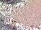 5-Hydroxytryptamine Receptor 1D antibody, A06046, Boster Biological Technology, Immunohistochemistry paraffin image 