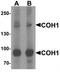 Vacuolar protein sorting-associated protein 13B antibody, TA320121, Origene, Western Blot image 