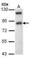 Sodium Channel Epithelial 1 Beta Subunit antibody, GTX108842, GeneTex, Western Blot image 