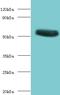 Cholinergic Receptor Nicotinic Alpha 1 Subunit antibody, LS-C318507, Lifespan Biosciences, Western Blot image 