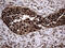 SSU72 Homolog, RNA Polymerase II CTD Phosphatase antibody, M06296, Boster Biological Technology, Immunohistochemistry paraffin image 