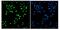 SWI/SNF Related, Matrix Associated, Actin Dependent Regulator Of Chromatin, Subfamily A, Member 2 antibody, M01888, Boster Biological Technology, Immunofluorescence image 