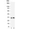 Aquaporin 5 antibody, R30332, NSJ Bioreagents, Western Blot image 