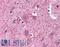 Chaperonin Containing TCP1 Subunit 2 antibody, LS-B4861, Lifespan Biosciences, Immunohistochemistry frozen image 