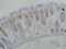 Galectin 3 antibody, GTX34035, GeneTex, Immunohistochemistry paraffin image 