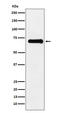 P21 (RAC1) Activated Kinase 4 antibody, MP01723, Boster Biological Technology, Western Blot image 