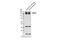 Solute Carrier Family 12 Member 2 antibody, 14581S, Cell Signaling Technology, Western Blot image 