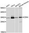 Cyclin Dependent Kinase 4 antibody, A0016, ABclonal Technology, Western Blot image 