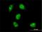 MYC Associated Factor X antibody, H00004149-M01, Novus Biologicals, Immunofluorescence image 