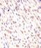 Mediator Complex Subunit 12 antibody, M00828, Boster Biological Technology, Immunohistochemistry paraffin image 