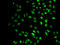 SET Domain Containing 2, Histone Lysine Methyltransferase antibody, STJ25493, St John