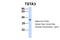 Tissue Specific Transplantation Antigen P35B antibody, ARP58679_P050, Aviva Systems Biology, Western Blot image 