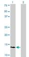 RNA Polymerase III Subunit K antibody, H00051728-M01, Novus Biologicals, Western Blot image 