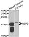 Retinol Binding Protein 2 antibody, A6717, ABclonal Technology, Western Blot image 