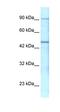 Gamma-Aminobutyric Acid Type A Receptor Pi Subunit antibody, orb327619, Biorbyt, Western Blot image 