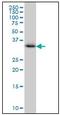 Crystallin Mu antibody, AM20873PU-N, Origene, Western Blot image 