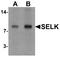 Selenoprotein K antibody, A31964, Boster Biological Technology, Western Blot image 