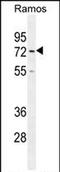 Hyaluronan Mediated Motility Receptor antibody, PA5-71581, Invitrogen Antibodies, Western Blot image 