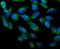 Aryl Hydrocarbon Receptor Interacting Protein antibody, PB9042, Boster Biological Technology, Immunofluorescence image 